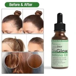 TruGlow Batana Oil 15 TruGlow Batana Oil -Primal Shop 710CqMkx qL. SX466