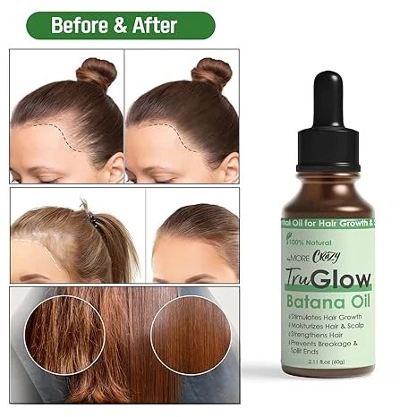 TruGlow Batana Oil 9 TruGlow Batana Oil - Image 7